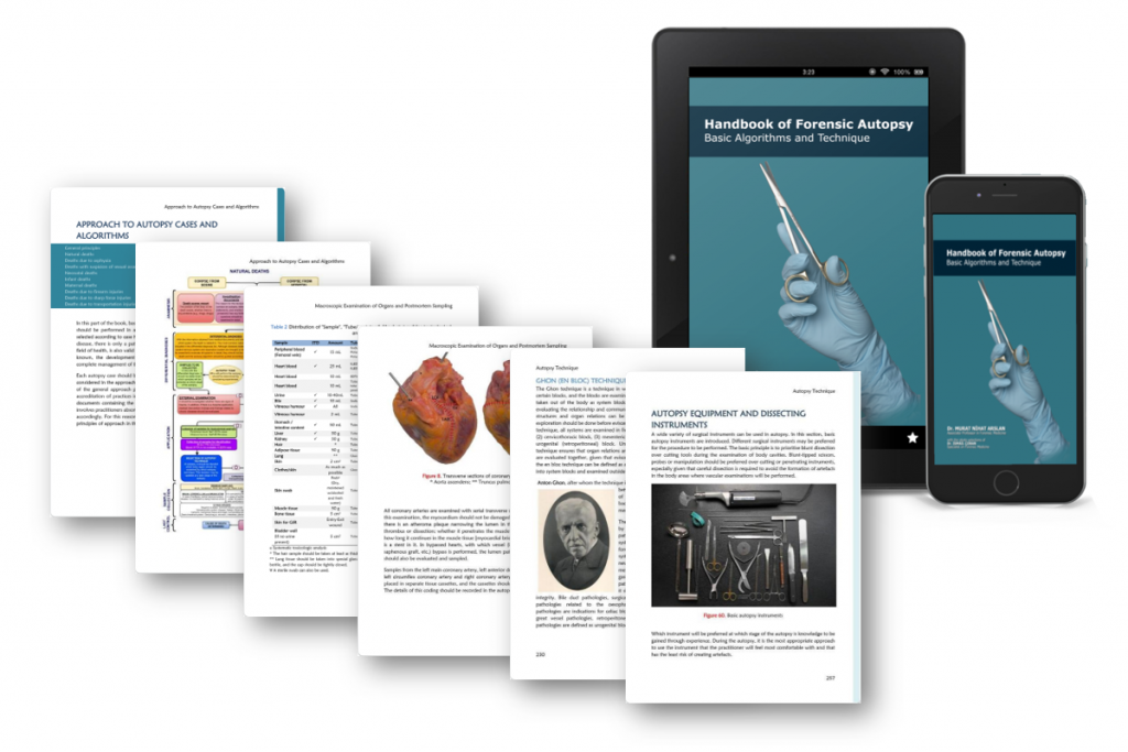 Handbook of Forensic Autopsy